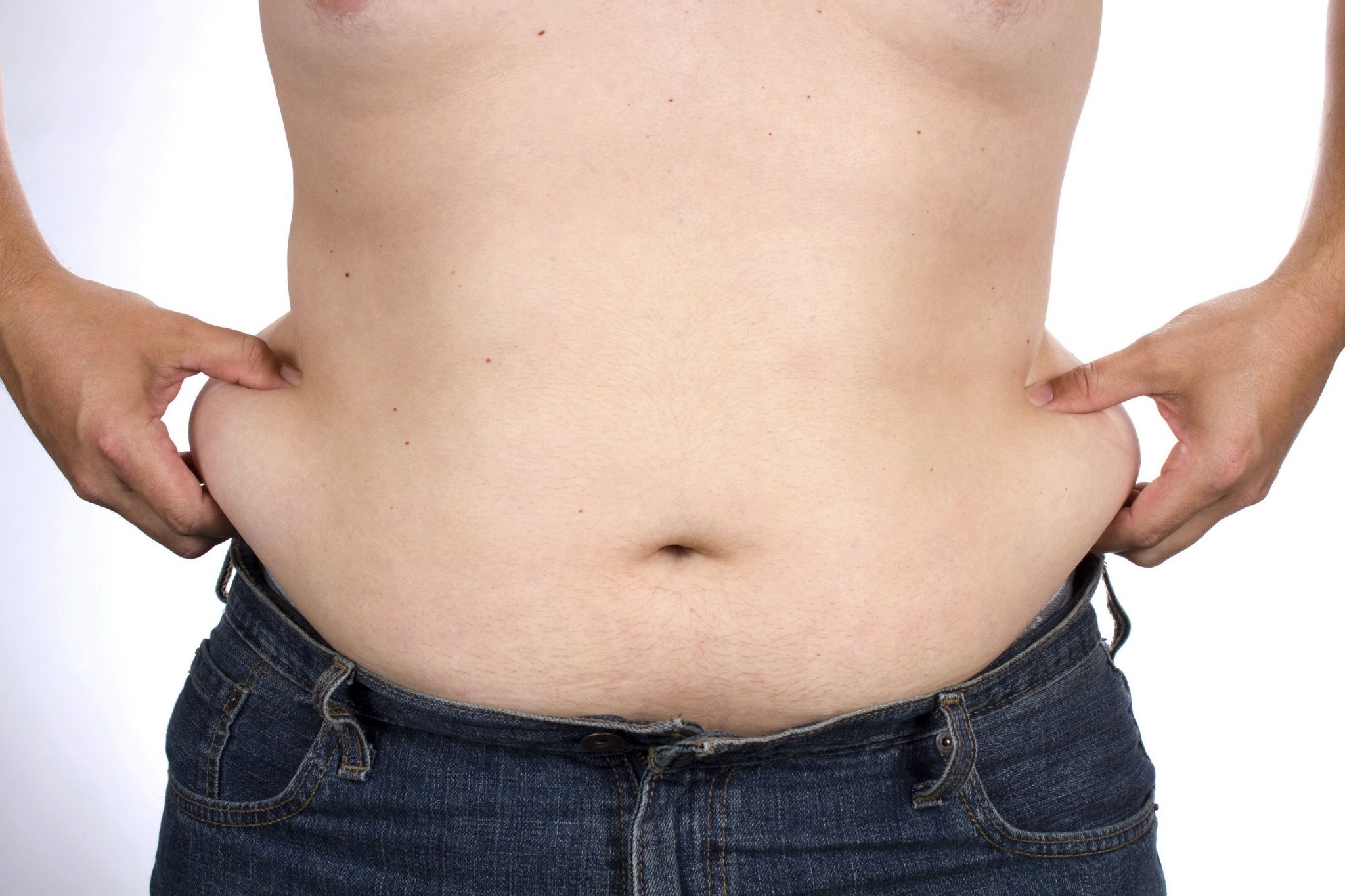 Eliminate Love Handles with Liposuction of the Flanks!